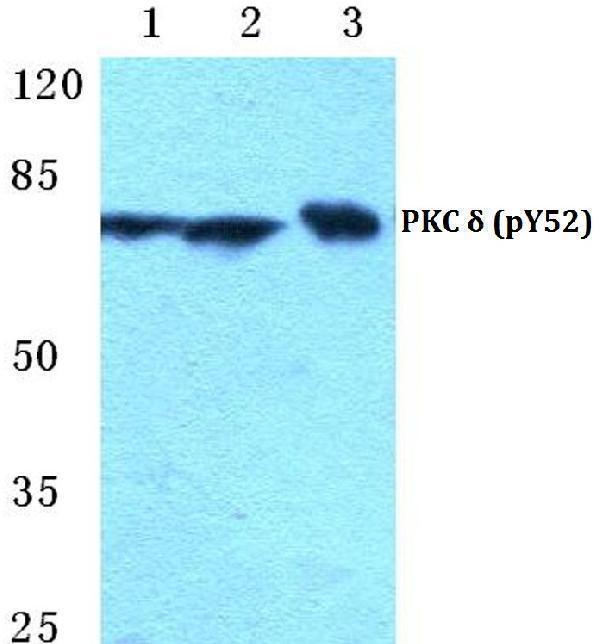 a00822y52 prkcd primary antiboties wb testing 1