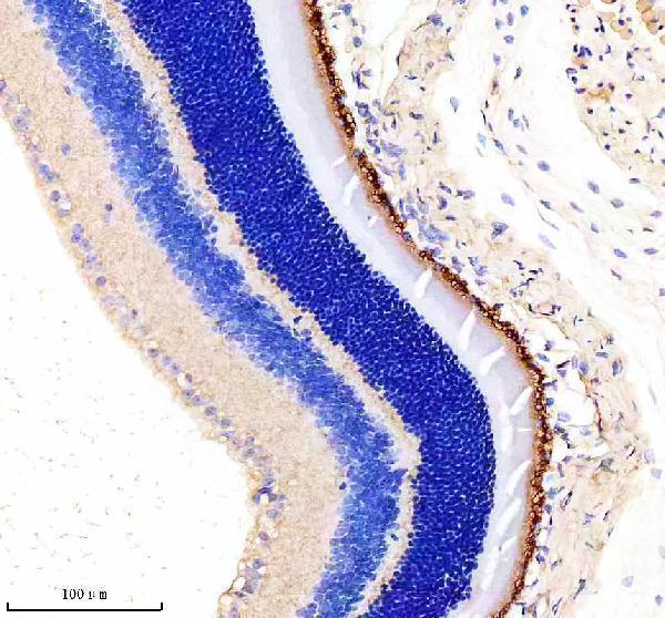  IHC analysis of RPE65 using anti-RPE65 antibody (A00824-1)