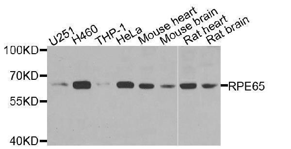 Western blot analysis of Mouse eye, using RPE65 antibody  at  1:3460 dilution