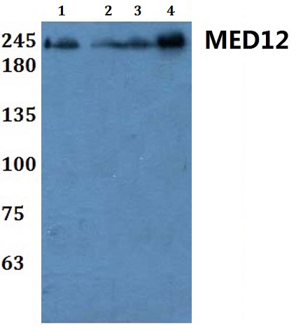 Western blot (WB) analysis of MED12 polyclonal antibody at 1:500 dilution
Lane1:HEK293T whole cell lysate
Lane2:H9C2 whole cell lysate
Lane3:sp20 whole cell lysate
Lane4:PC12 whole cell lysate