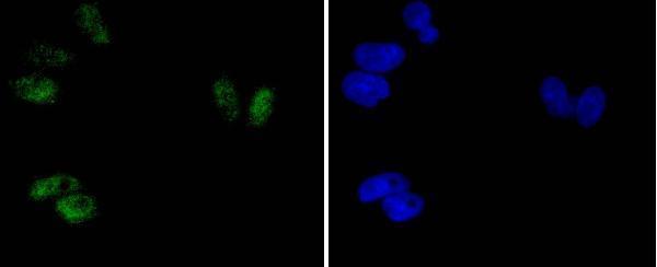 ICC staining phospho-ATF2(T71) in Hela cells (green)