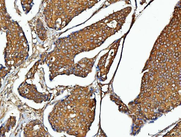  IHC analysis of EEF2 using anti-EEF2 antibody (A00830-1)