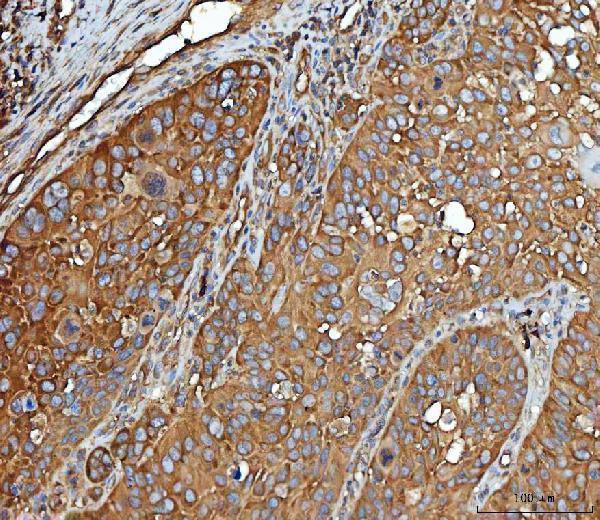  IHC analysis of EEF2 using anti-EEF2 antibody (A00830-1)