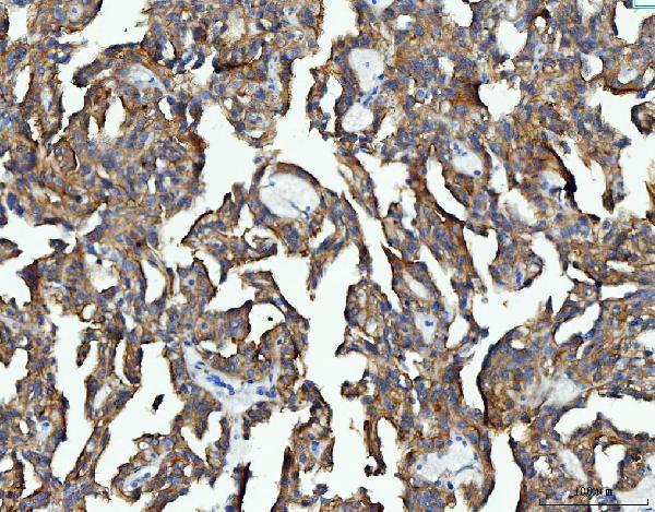 a00830 1 eef2 primary antibodies ihc testing 5_1