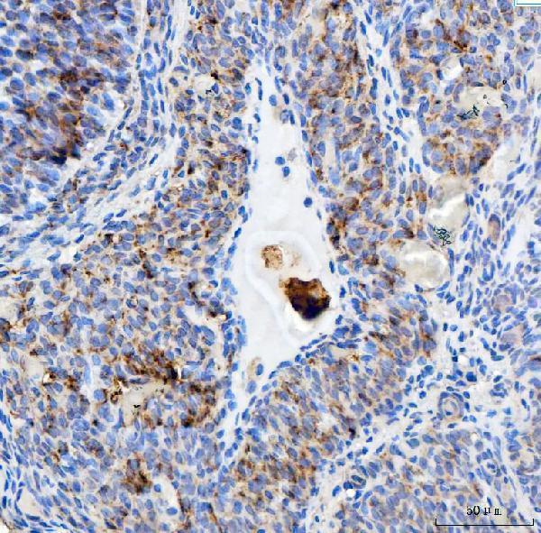 a00830 1 eef2 primary antibodies ihc testing 7