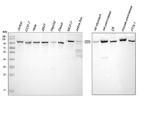  Western blot analysis of EEF2 using anti-EEF2 antibody (A00830-1)