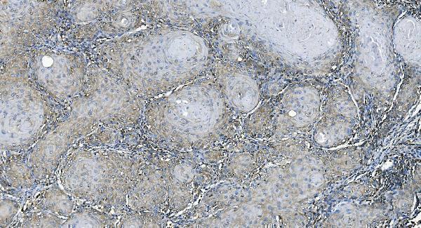 a00830 2 eef2 primary antibodies ihc testing 4