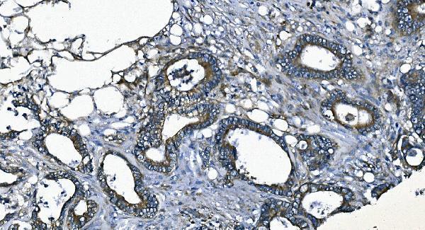 a00830 2 eef2 primary antibodies ihc testing 8