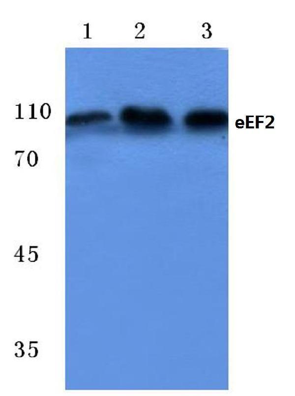 Western blot (WB) analysis of eEF2 (A50) polyclonal antibody at 1:500 dilution
Lane1:HepG2 cell lysate
Lane2:Mouse kidney tissue lysate
Lane3:Rat kidney tissue lysate
