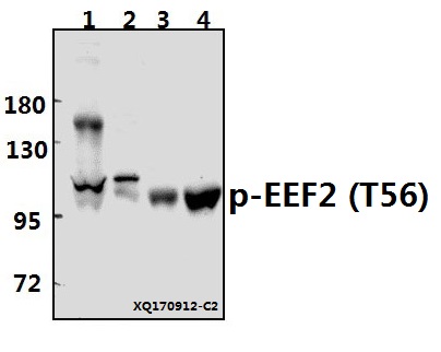 Western blot (WB) analysis of p-EEF2 (T56) pAb at 1:500 dilution
Lane1:K562 whole cell lysate(40ug)
Lane2:HEK293T whole cell lysate(10ug)
Lane3:The Liver tissue lysate of Rat(40ug)
Lane4:The Liver tissue lysate of Mouse(40ug)