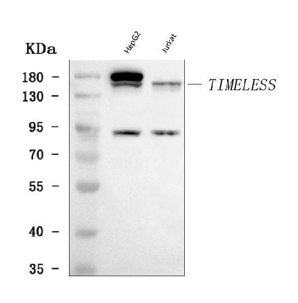 Western blot analysis of TIMELESS using anti-TIMELESS antibody (A00831)
