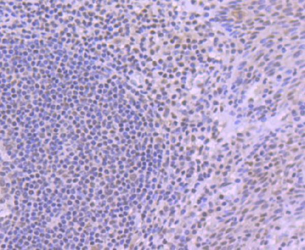 a00833 yy1 primary antiboties ihc testing 2