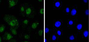 ICC staining RelB in A549 cells (green)