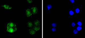 ICC staining RelB in SW480 cells (green)