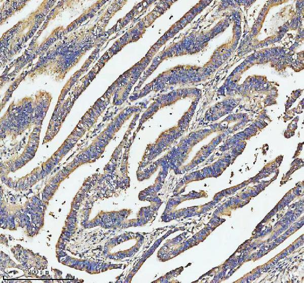  IHC analysis of SOS1 using anti-SOS1 antibody (A00837-1)