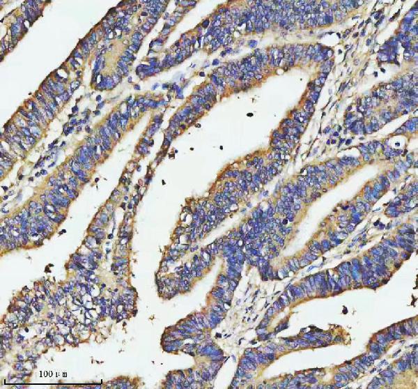  IHC analysis of SOS1 using anti-SOS1 antibody (A00837-1)