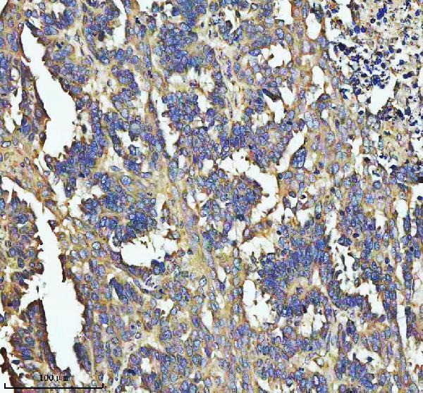 a00837 1 sos1 primary antibodies ihc testing 5