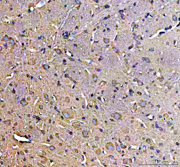 a00837 1 sos1 primary antibodies ihc testing 6