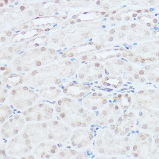 Immunohistochemistry of paraffin-embedded mouse kidney using NEDD9 Rabbit pAb  at dilution of 1:100 