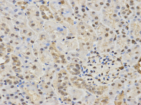 a00839 1 hdac3 primary antiboties ip testing 2