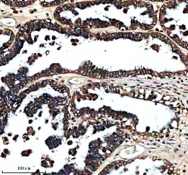 IHC analysis of FXN using anti-FXN antibody (A00842-1)