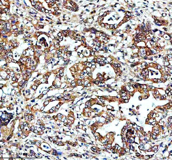 IHC analysis of FXN using anti-FXN antibody (A00842-1)