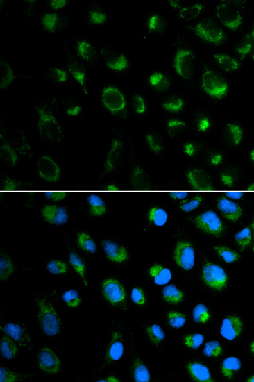 Immunohistochemistry of paraffin-embedded human liver cancer using FXN / Frataxin Rabbit pAb  at dilution of 1:100 