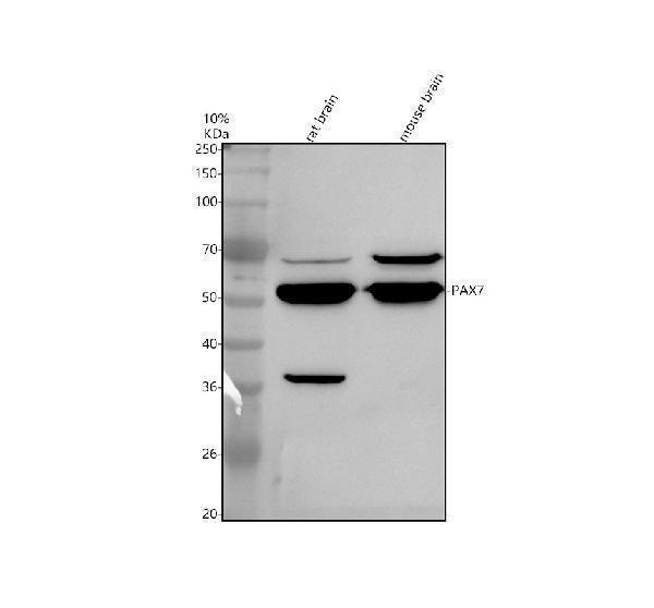 Western blot analysis of PAX7 using anti-PAX7 antibody (A00845-2)