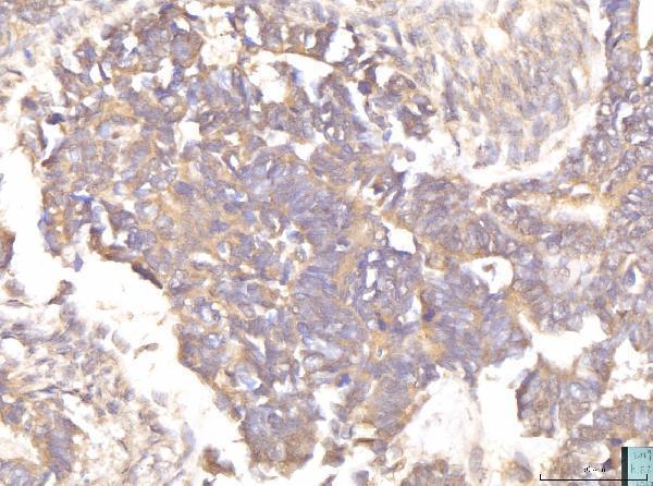  IHC analysis of EIF4B using anti-EIF4B antibody (A00846-1)