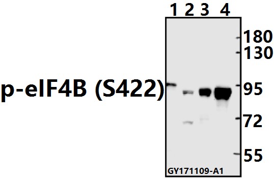 Western blot (WB) analysis of p-eIF4B (S422) pAb at 1:500 dilution
Lane1:The Brain tissue lysate of Rat(40ug)
Lane2:K562 whole cell lysate(40ug)
Lane3:A375 whole cell lysate(40ug)
Lane4:HCT116 whole cell lysate(40ug)