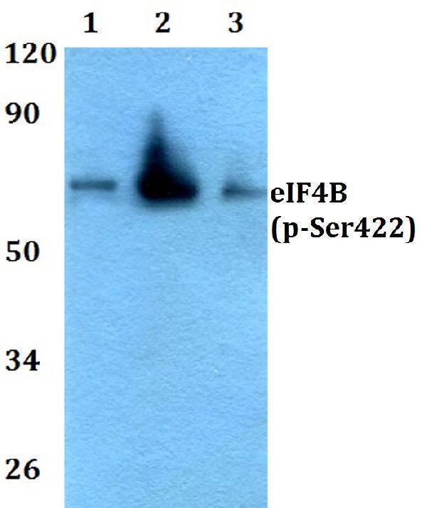 a00846s422 eif4b primary antiboties wb testing 1