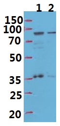 Western blot (WB) analysis of IFI-16 polyclonal antibody at 1:500 dilution
Lane1:Hela whole cell lysate(40ug)
Lane2:HepG2 whole cell lysate(40ug)