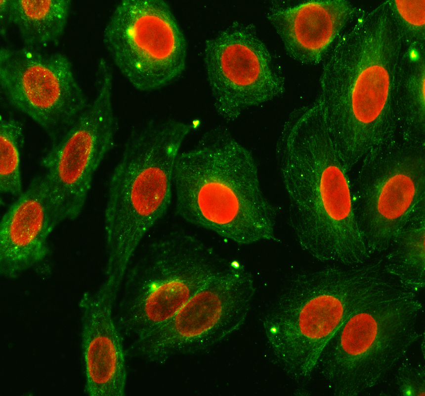 a00848 3 ifi16 primary antibodies if testing 1