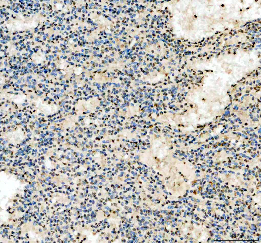 IHC analysis of IFI16 using anti-IFI16 antibody (A00848-3)