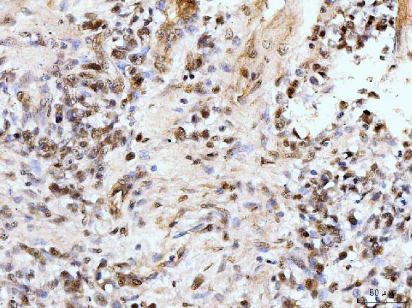 a00848 3 ifi16 primary antibodies ihc testing 5