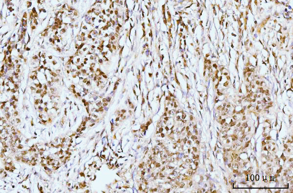 a00848 3 ifi16 primary antibodies ihc testing 6
