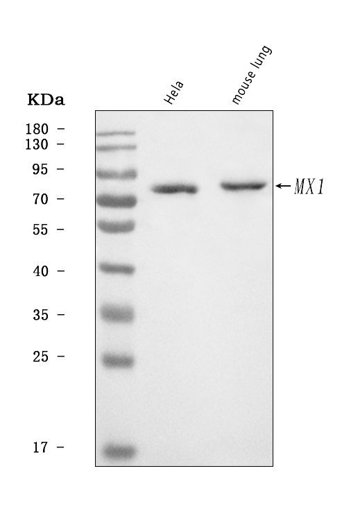  Western blot analysis of MX1 using anti-MX1 antibody (A00849-1)