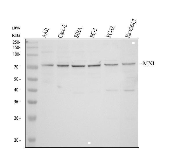Western blot analysis of MX1 using anti-MX1 antibody (A00849-3)