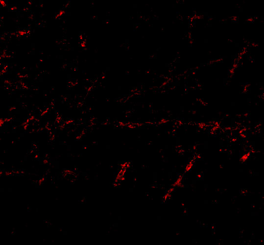 Immunofluorescence of LGI1 in Human Brain cells with LGI1 antibody at 20 μg/mL
