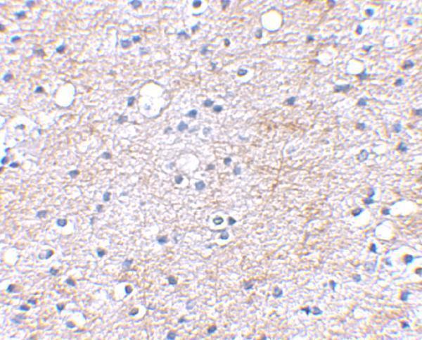 Immunohistochemical staining of human brain tissue using LGI1 antibody at 2