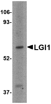 Western blot analysis of LGI1 in HeLa cell lysate with LGI1 antibody at 2 μg/mL