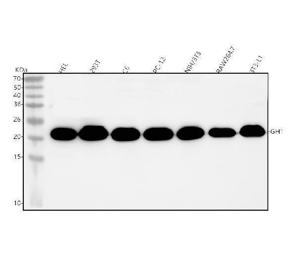  Western blot analysis of GH1 using anti-GH1 antibody (A00851-2)