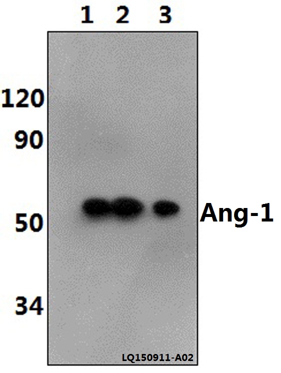 Western blot (WB) analysis of Ang-1 (E207) polyclonal antibody at 1:500 dilution
Lane1:PC12 whole cell lysate(40ug)
Lane2:NIH-3T3 whole cell lysate(40ug)
Lane3:Hela whole cell lysate(40ug)