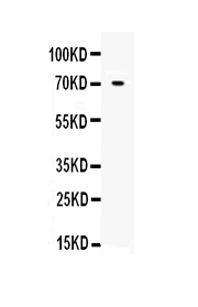  Western blot analysis of Angiopoietin-1 using anti-Angiopoietin-1 antibody (A00853)