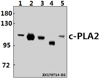 Western blot (WB) analysis of c-PLA2 (N499) pAb at 1:500 dilution
Lane1:THP-1 whole cell lysate(40ug)
Lane2:MEF whole cell lysate(10ug)
Lane3:H9C2 whole cell lysate(40ug)
Lane4:K562 whole cell lysate(10ug)
Lane5:Jurkat whole cell lysate(40ug)