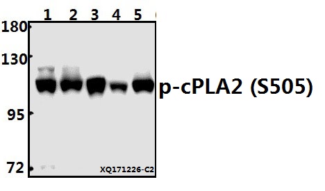 Western blot (WB) analysis of p-cPLA2 (S505) pAb at 1:500 dilution
Lane1:MCF-7 whole cell lysate(40ug)
Lane2:A549 whole cell lysate(40ug)
Lane3:The Uterus tissue lysate of Rat(40ug)
Lane4:The Uterus tissue lysate of Mouse(40ug)
Lane5:3T3-L1 whole cell lysate(40ug)