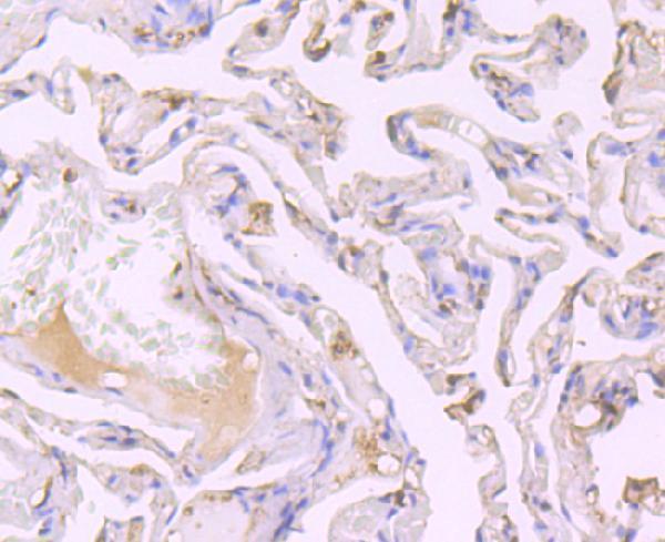 Immunohistochemical analysis of paraffin-embedded human lung cancer tissue using anti-SRC1 antibody
