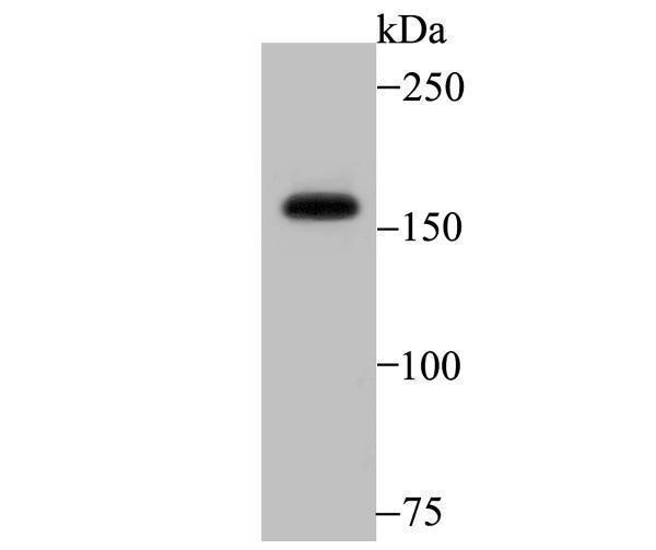 Western blot analysis of SRC1 on K562 cell lysate using anti- SRC1 antibody at 1/2,000 dilution