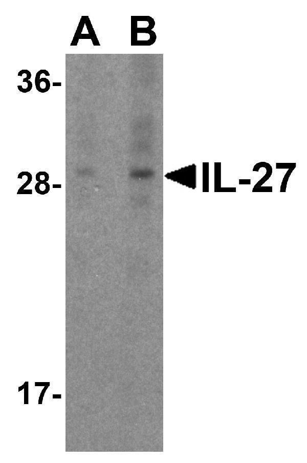 Western Blot Validation in Mouse A20 Cells
Loading: 15 μg of lysates per lane