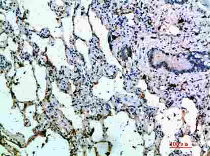 Immunohistochemical analysis of paraffin-embedded human-lung, antibody was diluted at 1:200